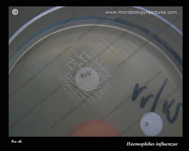 Haemophilus influenzae requires X and V factors X factor, V factor, X+V factors